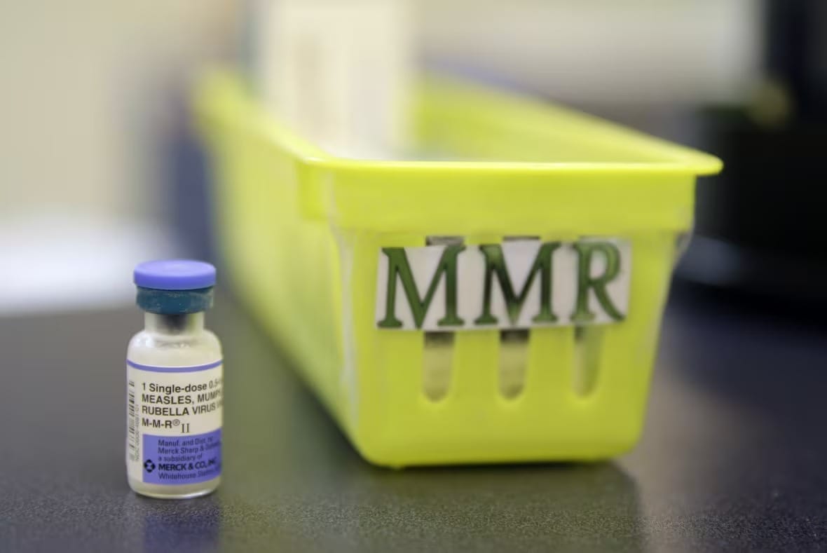 Measles Outbreak