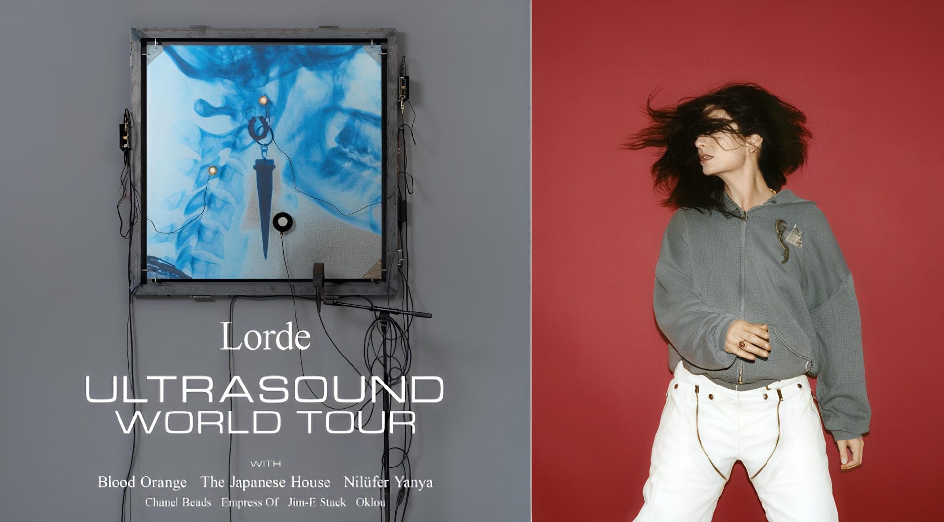 Lorde : Ultrasound Tour